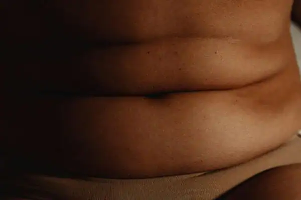 The Hidden Connection: How Stress Shapes Your Fitness and Body Composition 3 image of what stress can do on the stomach area and how Lipo 360 Bakewell can help to change your body shape.