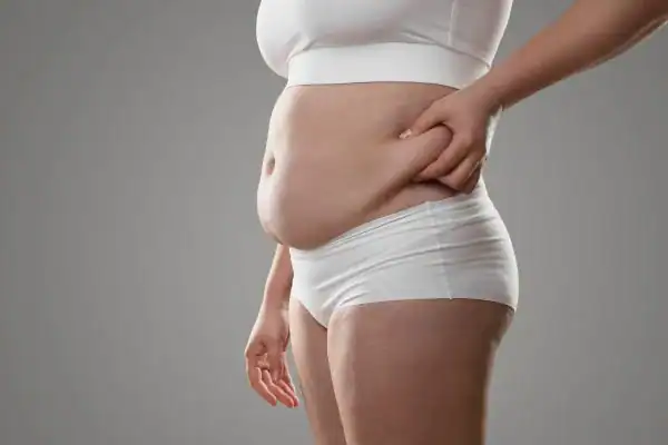 Image of stress belly Bakewell How Lipo 360 can help manage your symptoms